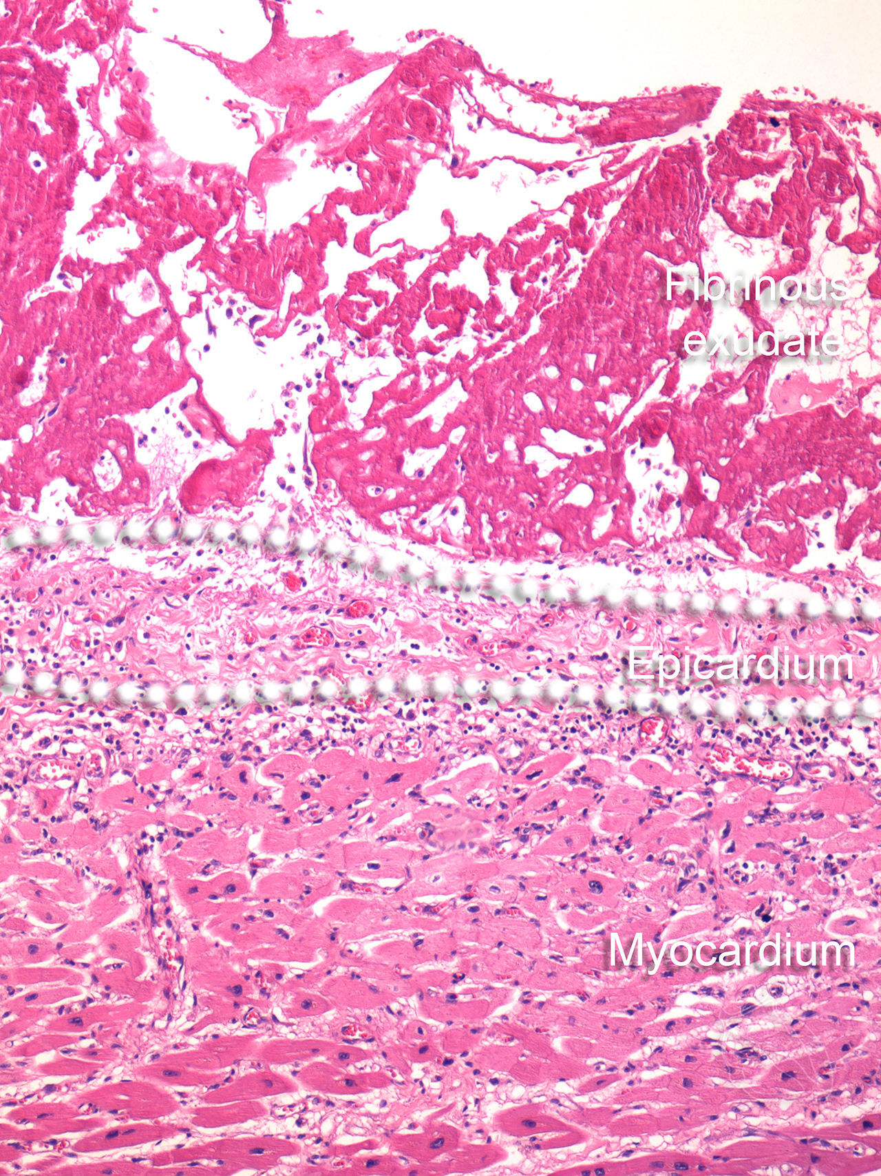 structure-of-the-human-pericardium-and-responses-to-pathologic